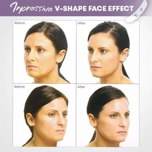DermaLift™ Unsichtbares Facelifting-Kit