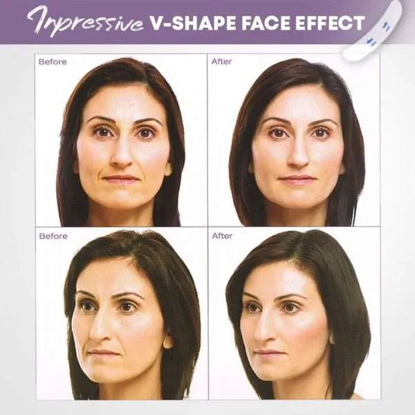 DermaLift™ Unsichtbares Facelifting-Kit